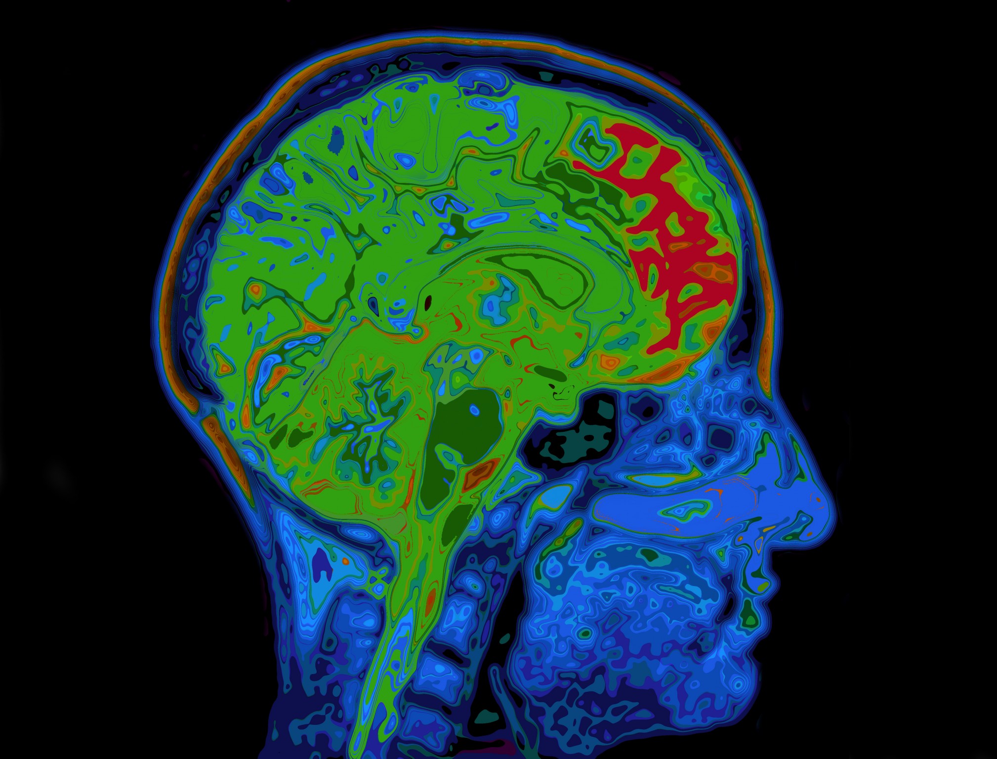 100_brains_missing_from_university_of_texas.jpg